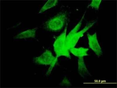 Immunocytochemistry/ Immunofluorescence: NDUFA9 Antibody (3D7) [H00004704-M01]