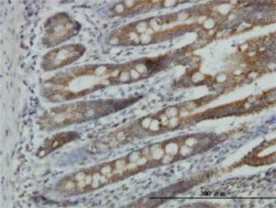 Immunohistochemistry-Paraffin: NDUFA9 Antibody (3D7) [H00004704-M01]