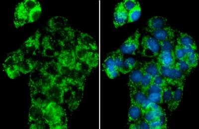 Immunocytochemistry/ Immunofluorescence: NDUFA9 Antibody [NBP3-13155]