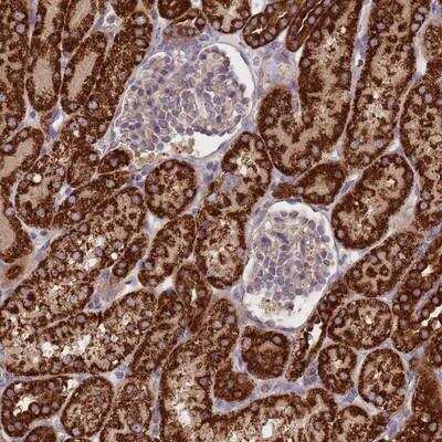 Immunohistochemistry: NDUFA9 Antibody [NBP2-13646]