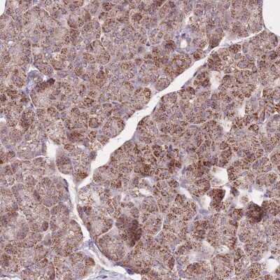 Immunohistochemistry-Paraffin: NDUFA9 Antibody [NBP2-13646]