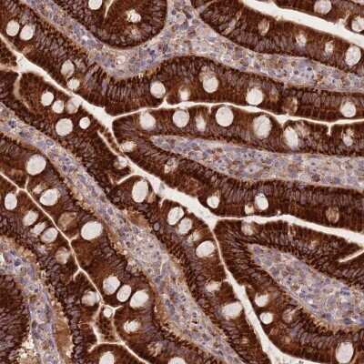 Immunohistochemistry-Paraffin: NDUFA9 Antibody [NBP2-13646]