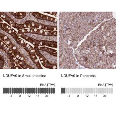 Immunohistochemistry-Paraffin: NDUFA9 Antibody [NBP2-13646]