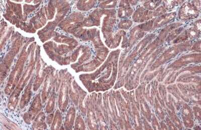 Immunohistochemistry-Paraffin: NDUFA9 Antibody [NBP3-13155]