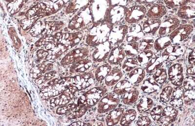 Immunohistochemistry-Paraffin: NDUFA9 Antibody [NBP3-13155]