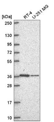 Western Blot: NDUFA9 Antibody [NBP2-57798]