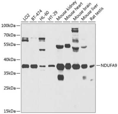 Western Blot: NDUFA9 AntibodyBSA Free [NBP2-94632]