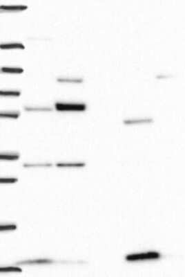 Western Blot: NDUFAB1 Antibody [NBP3-17896]