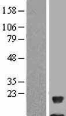 Western Blot: NDUFAB1 Overexpression Lysate [NBL1-13547]