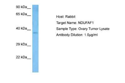 Western Blot: NDUFAF1 Antibody [NBP2-85367]