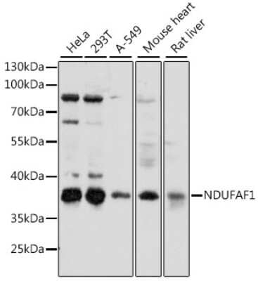 Western Blot: NDUFAF1 AntibodyAzide and BSA Free [NBP2-94232]