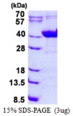 SDS-PAGE: Recombinant Human NDUFAF1 His Protein [NBP2-23263]