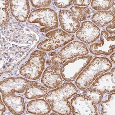 Immunohistochemistry: NDUFAF2 Antibody [NBP2-47359]
