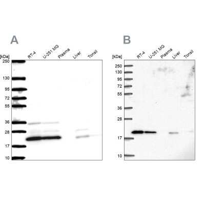 Western Blot: NDUFAF2 Antibody [NBP2-47359]