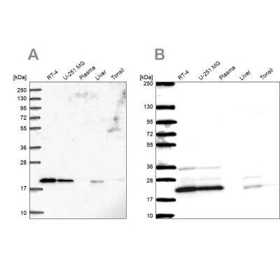 Western Blot: NDUFAF2 Antibody [NBP2-56048]
