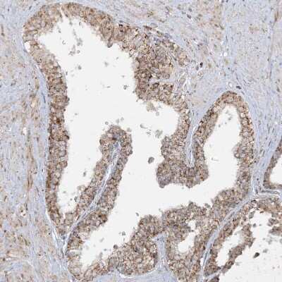 Immunohistochemistry: NDUFAF3 Antibody [NBP1-89382]