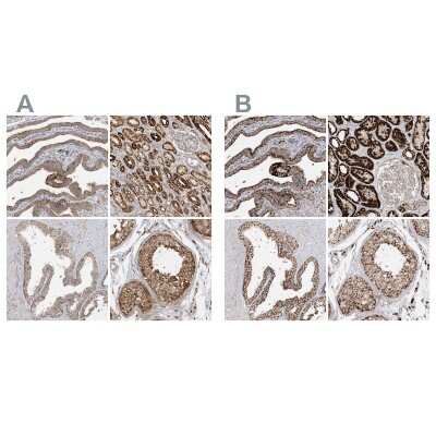 Immunohistochemistry-Paraffin: NDUFAF3 Antibody [NBP1-89382]