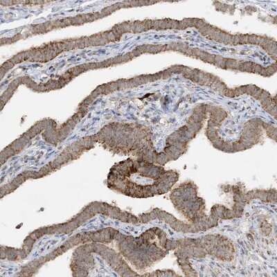 Immunohistochemistry-Paraffin: NDUFAF3 Antibody [NBP1-89382]