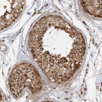 Immunohistochemistry-Paraffin: NDUFAF3 Antibody [NBP1-89382]