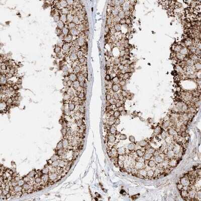 Immunohistochemistry-Paraffin: NDUFAF3 Antibody [NBP2-48638]