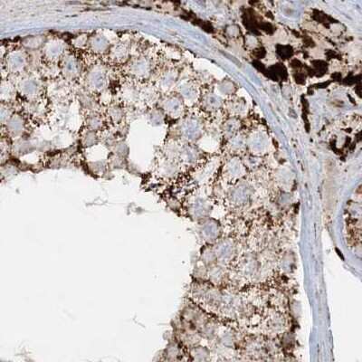 Immunohistochemistry-Paraffin: NDUFAF3 Antibody [NBP2-48638]