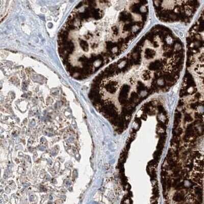 Immunohistochemistry-Paraffin: NDUFAF3 Antibody [NBP2-48638]