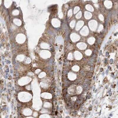 Immunohistochemistry-Paraffin: NDUFAF3 Antibody [NBP2-48638]