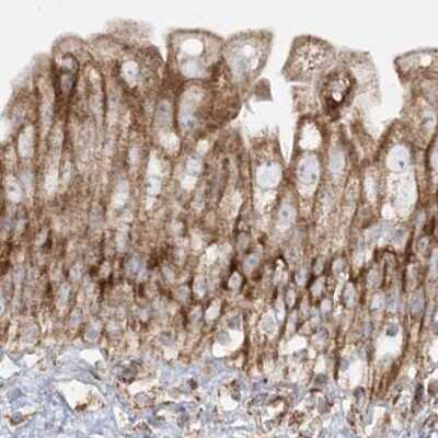 Immunohistochemistry-Paraffin: NDUFAF3 Antibody [NBP2-48638]