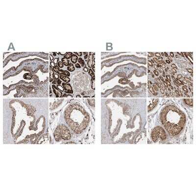 Immunohistochemistry-Paraffin: NDUFAF3 Antibody [NBP2-48638]