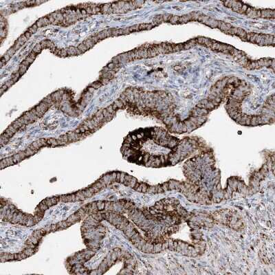 Immunohistochemistry-Paraffin: NDUFAF3 Antibody [NBP2-48638]