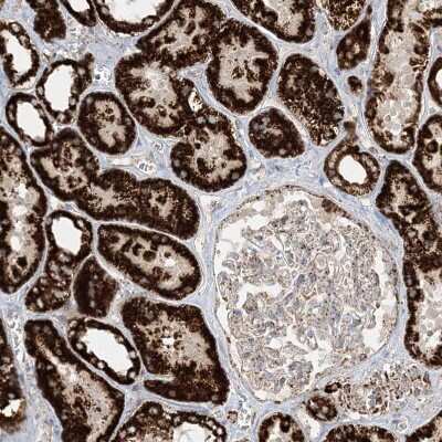 Immunohistochemistry-Paraffin: NDUFAF3 Antibody [NBP2-48638]