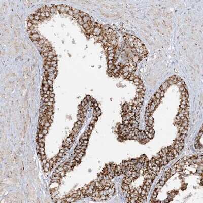 Immunohistochemistry-Paraffin: NDUFAF3 Antibody [NBP2-48638]