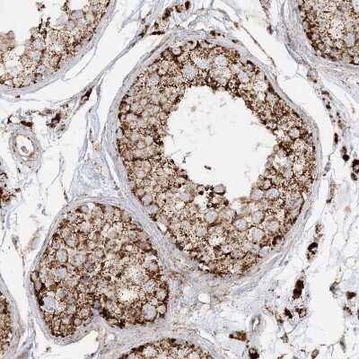 Immunohistochemistry-Paraffin: NDUFAF3 Antibody [NBP2-48638]