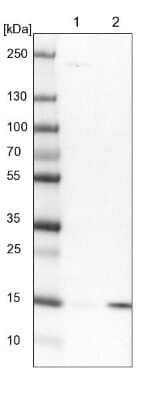 Western Blot: NDUFAF3 Antibody [NBP1-89382]