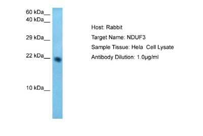 Western Blot: NDUFAF3 Antibody [NBP2-85369]