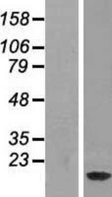 Western Blot: NDUFAF3 Overexpression Lysate [NBP2-04666]