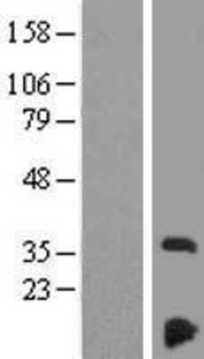 Western Blot: NDUFAF3 Overexpression Lysate [NBP2-10090]