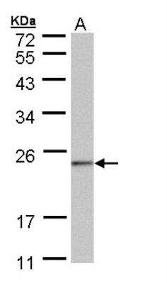 Western Blot: NDUFAF4 Antibody [NBP1-32722]