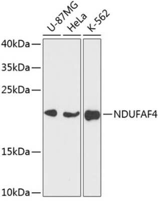 Western Blot: NDUFAF4 AntibodyAzide and BSA Free [NBP2-93264]