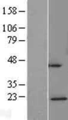 Western Blot: NDUFAF4 Overexpression Lysate [NBL1-08537]