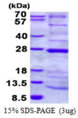 SDS-PAGE: Recombinant Human NDUFAF4 His Protein [NBP2-23264]