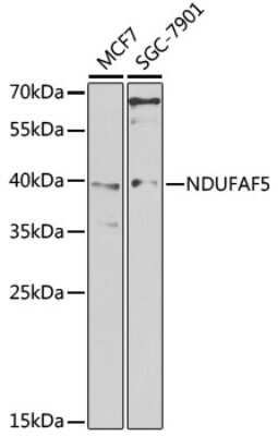 Western Blot: NDUFAF5 AntibodyBSA Free [NBP2-93003]