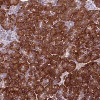 Immunohistochemistry: NDUFAF6 Antibody [NBP2-48970]