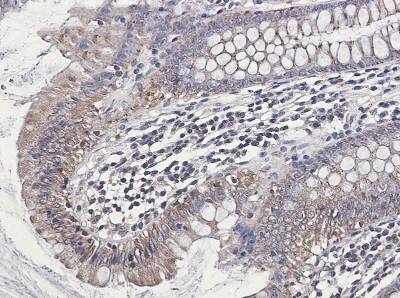 Immunohistochemistry-Paraffin: NDUFB1 Antibody (S04-4H3) [NBP3-19813]
