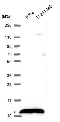 Western Blot: NDUFB1 Antibody [NBP2-57170]