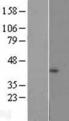 Western Blot: NDUFB1 Overexpression Lysate [NBP2-07859]