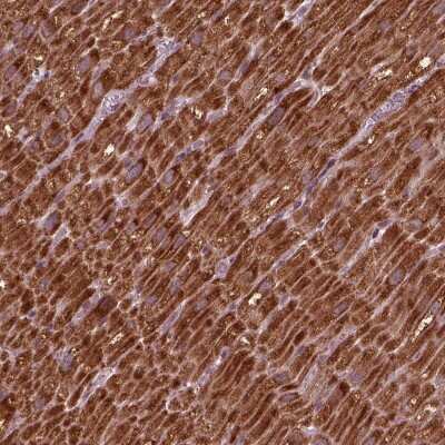 Immunohistochemistry-Paraffin: NDUFB10 Antibody [NBP2-57790]