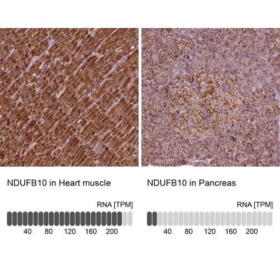 Immunohistochemistry-Paraffin: NDUFB10 Antibody [NBP2-57790]