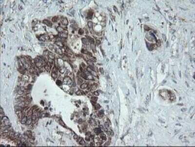 Immunohistochemistry: NDUFB10 Antibody (OTI1H6) [NBP2-46118]