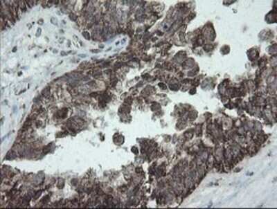 Immunohistochemistry: NDUFB10 Antibody (OTI1H6) [NBP2-46118]